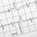 Rollo papel ECG 060x15x15